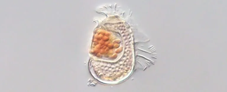 Усередині цього планктону знаходиться крихітний мікроб, який діє радше як вірус, ніж як клітина Усередині цього планктону знаходиться крихітний мікроб, який діє радше як вірус, ніж як клітина