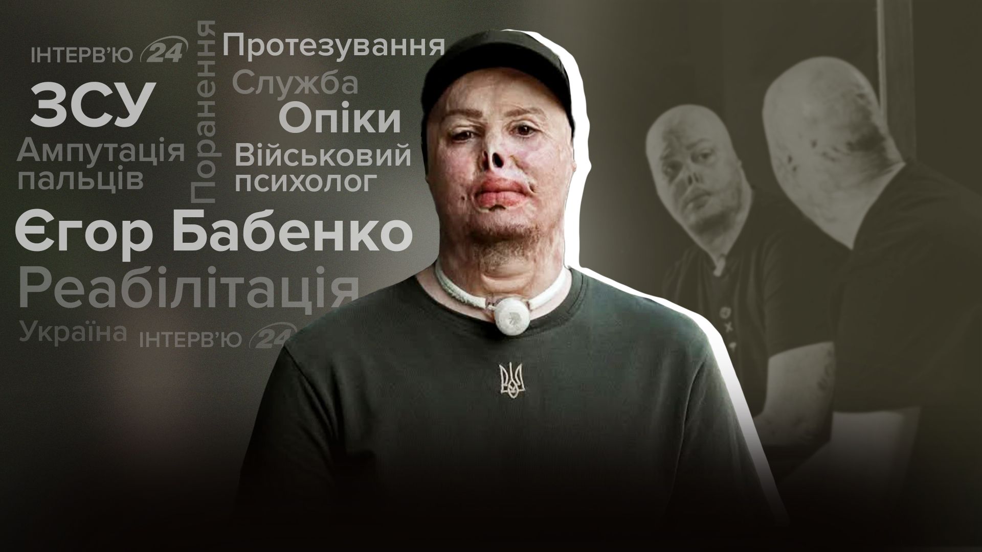 Как Егор Бабенко получил ранение на войне