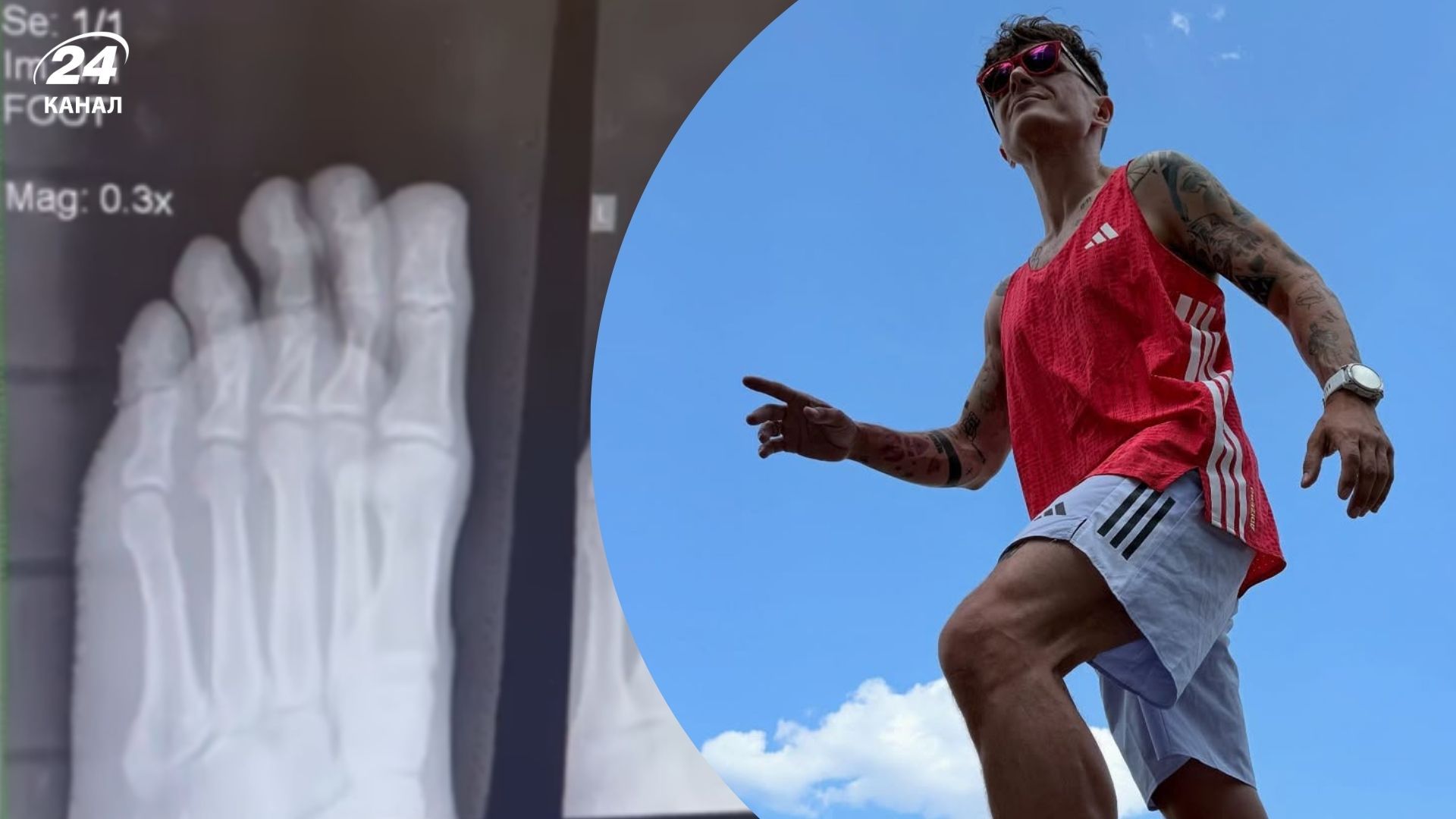 Анатолий Анатолич сломал пальцы Анатолий Анатолич сломал пальцы