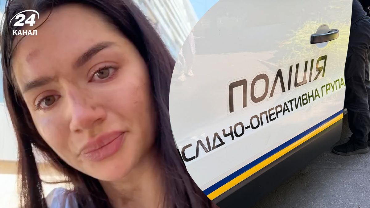 Олександра Миколюк пережила напад в Одесі 10 серпня