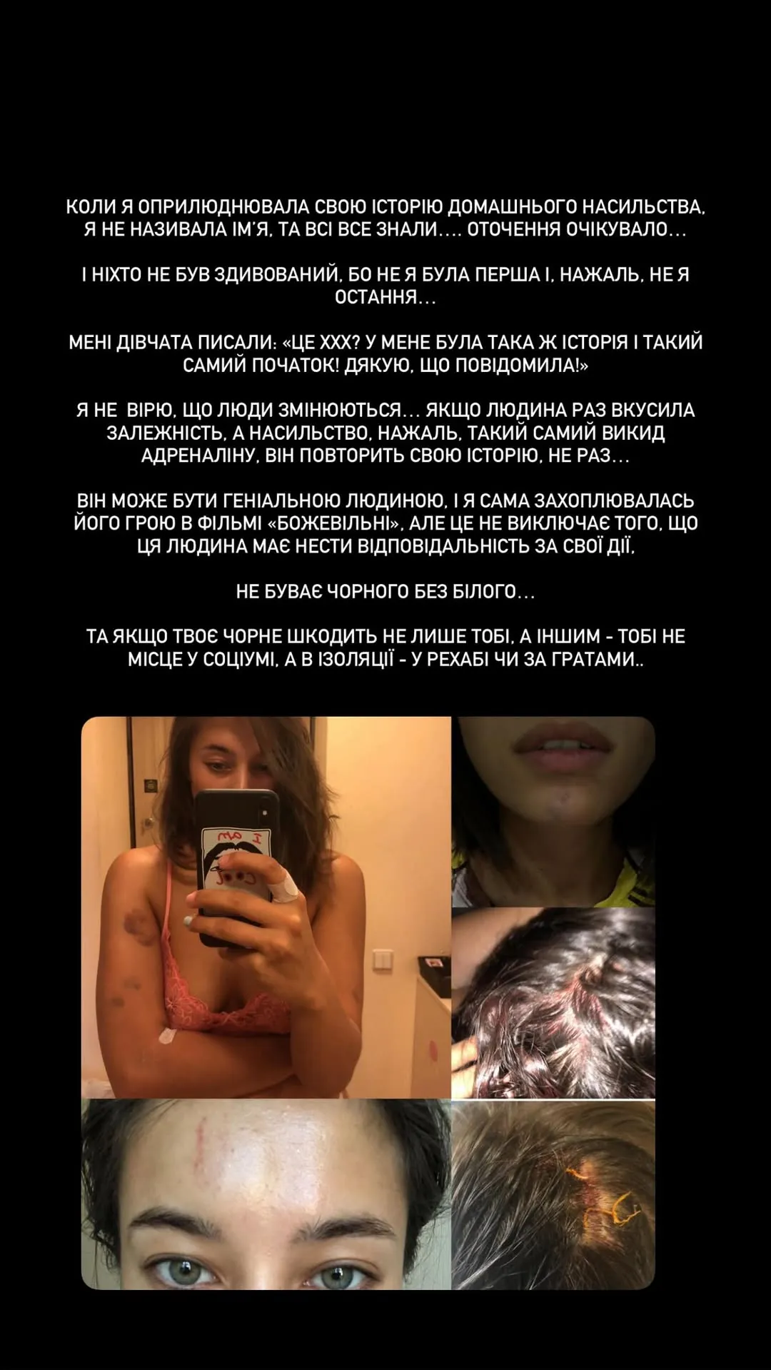 Сториз Анны Неплях Сториз Анны Неплях