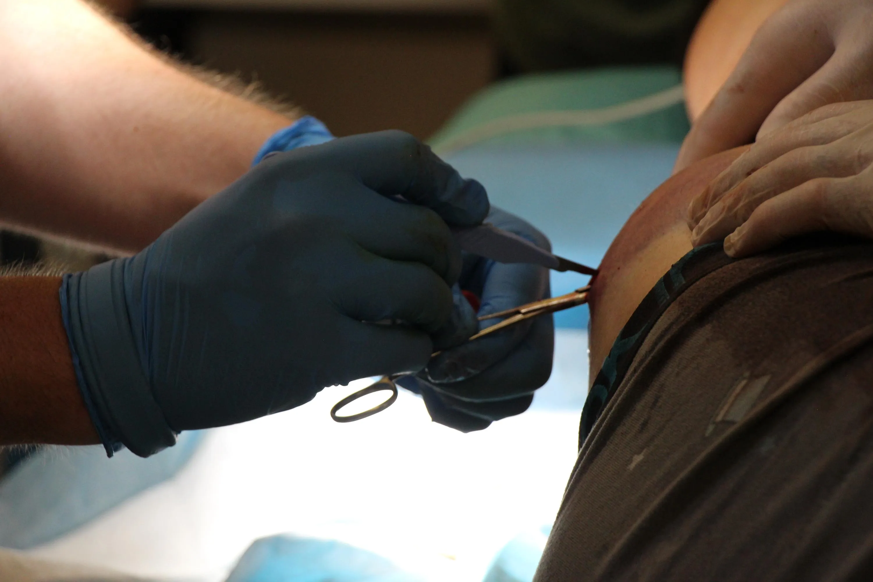 Стабілізаційний пункт Стабілізаційний пункт