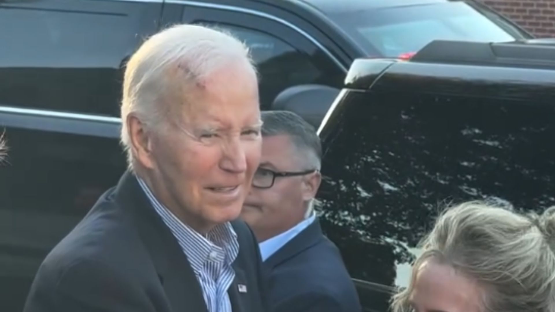 Джо Байден з рубцем на голові