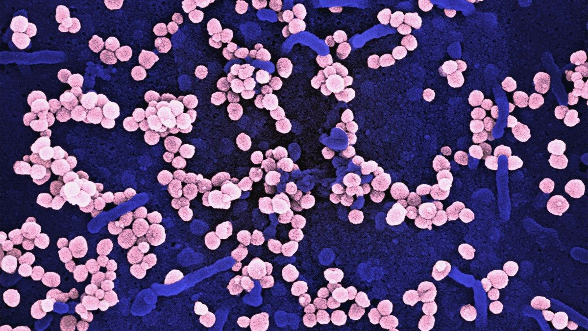 Причина Юстиніанової чуми встановлена вченими через 1500 років