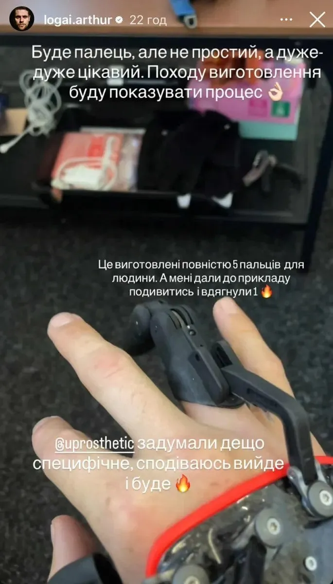 Артур Логай приміряв протез