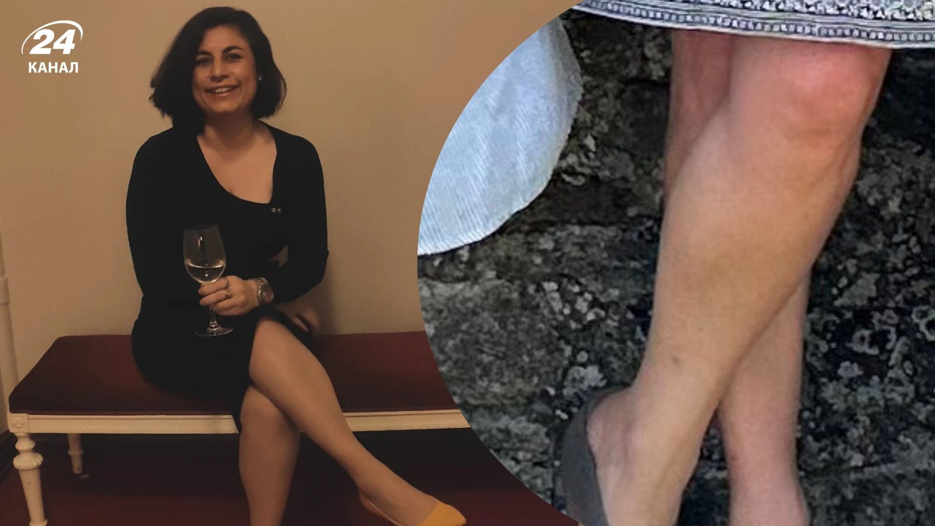 В сети люди публикуют фото своих обнаженных ног после скандала на иранском ТВ В сети люди публикуют фото своих обнаженных ног после скандала на иранском ТВ