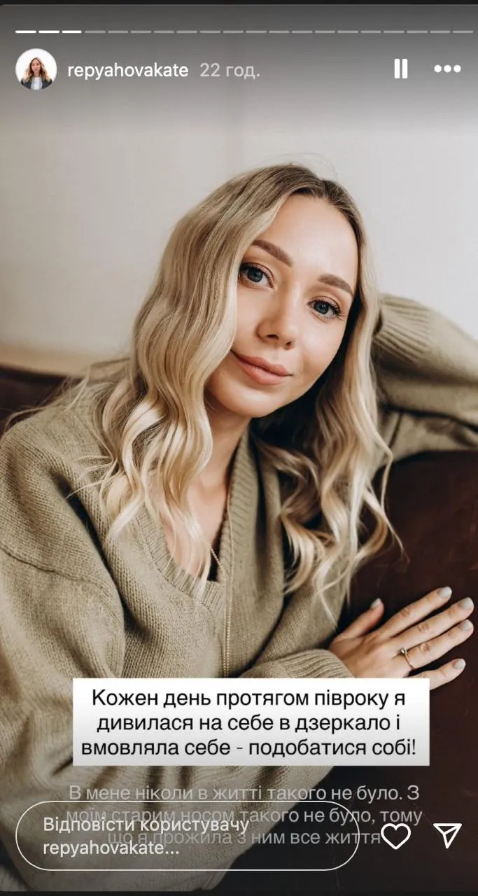 Катерина Репяхова про невдалу пластику