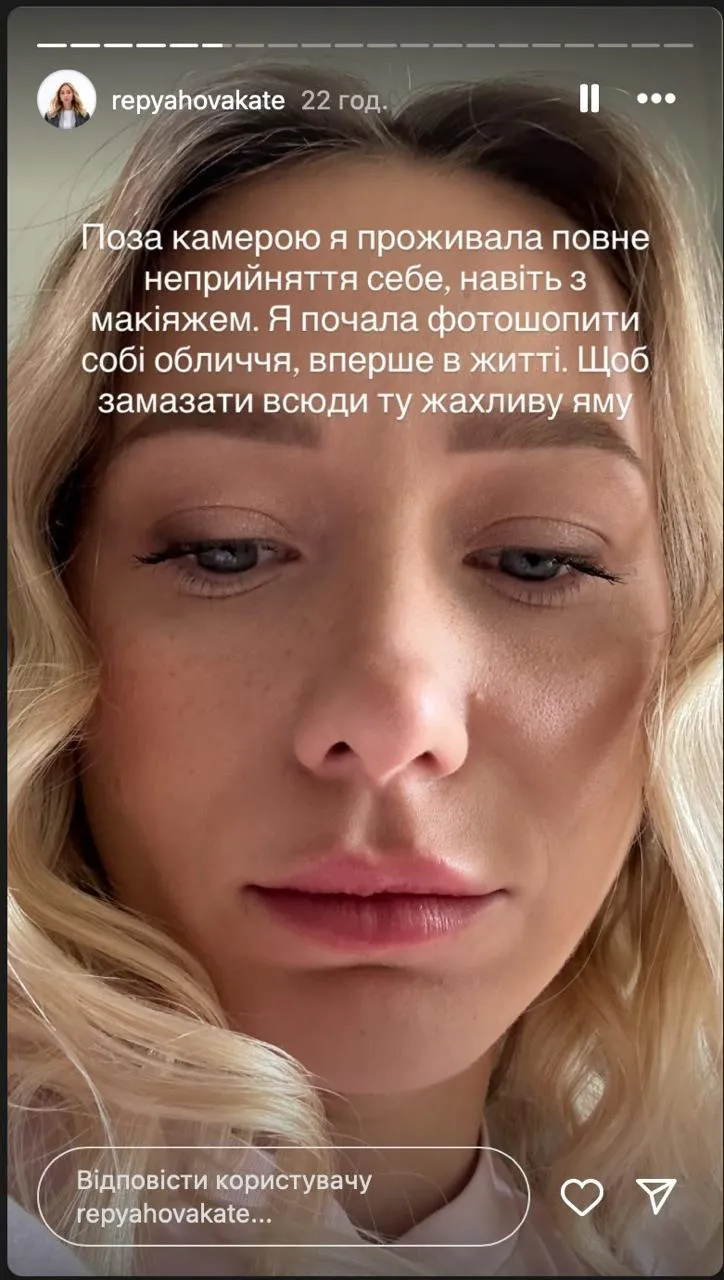 Катерина Репяхова про невдалу пластику 