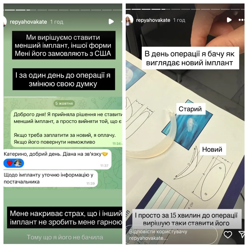 Катерина Репяхова вагалась з імплантом Катерина Репяхова вагалась з імплантом