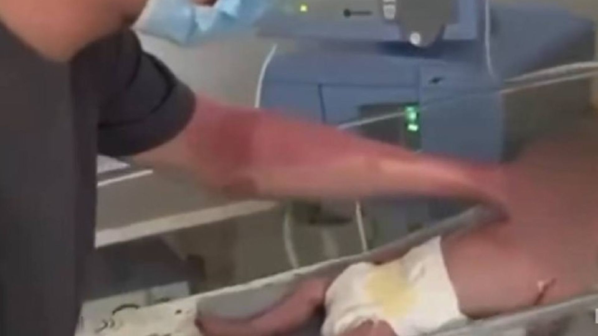 Отец увидел своего недоношенного ребенка после атаки 7 сентября