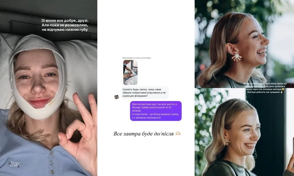 Екатерина Репяхова сделала пластическую операцию 