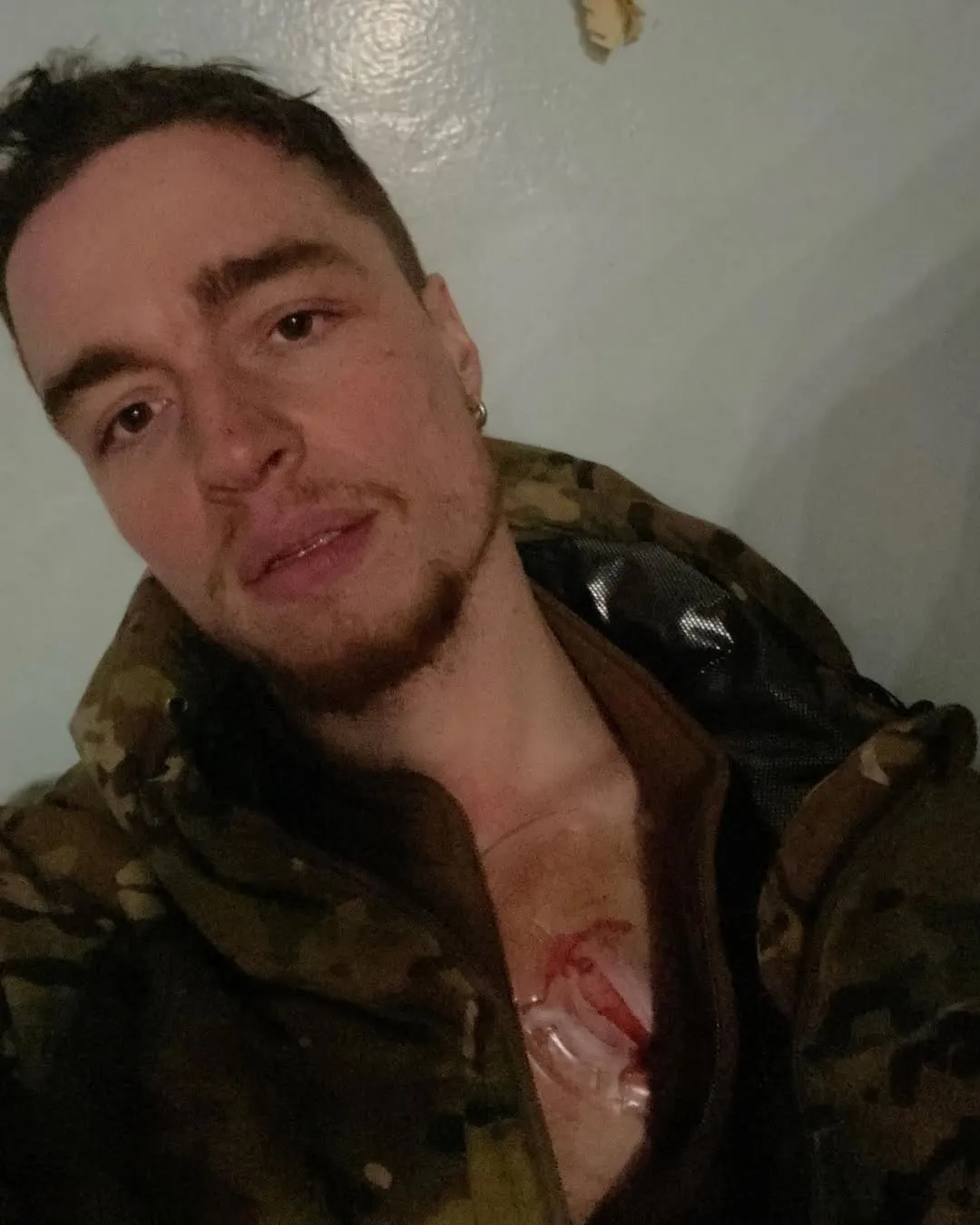 Назар Грабар зазнав поранення на фронті 