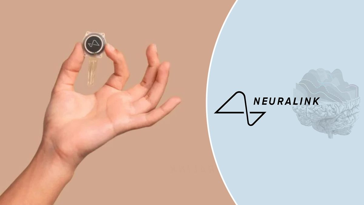 Neuralink запускає масове виробництво імплантів для мозку в 2026 році Neuralink запускає масове виробництво імплантів для мозку в 2026 році