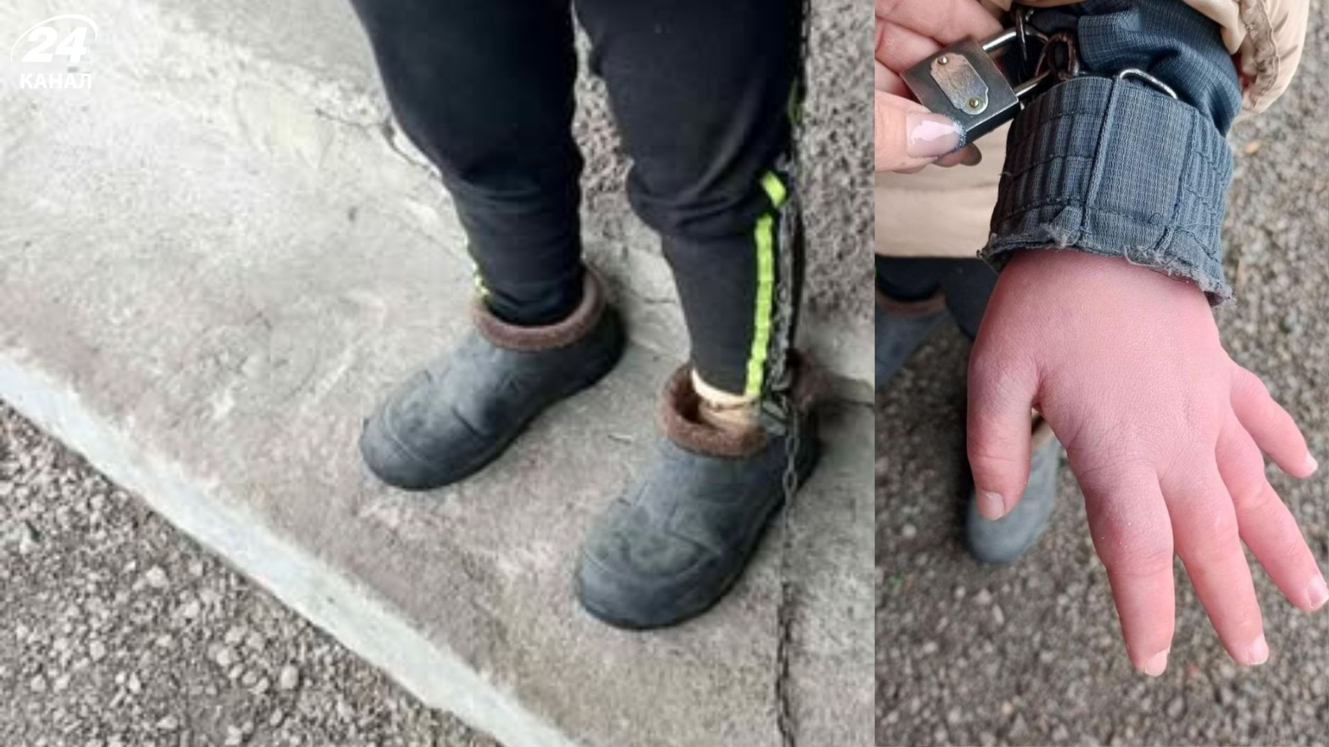 На Кіровоградщині в дитбудинку дівчину тримали на ланцюгах