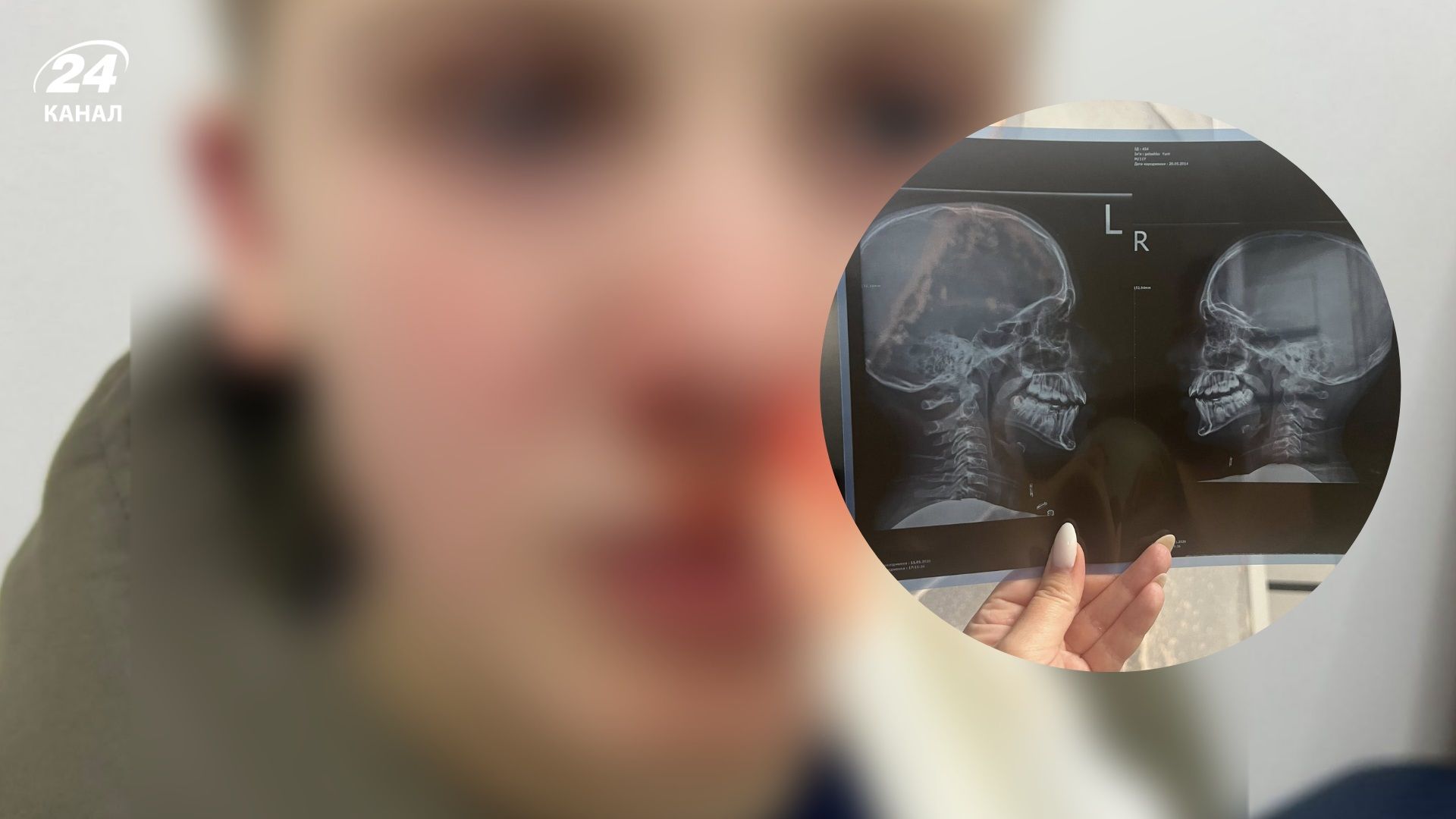 У Львові чоловік напав на школяра під час катання на санчатах - 24 Канал У Львові чоловік напав на школяра під час катання на санчатах - 24 Канал