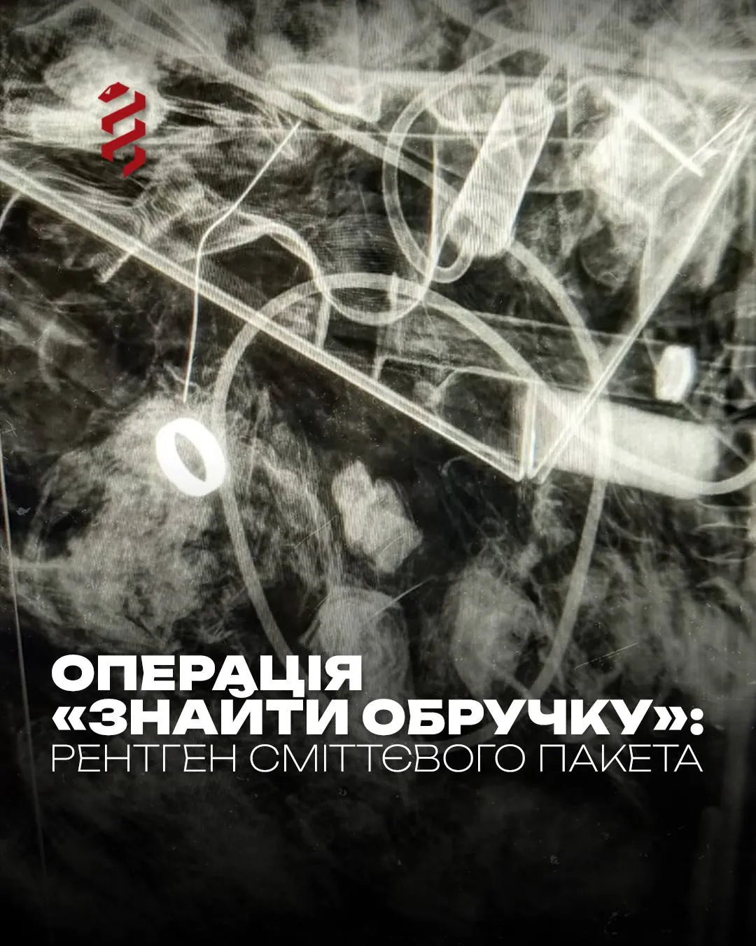 Медики знайшли обручку військового у смітті з допомогою рентгену Медики знайшли обручку військового у смітті з допомогою рентгену