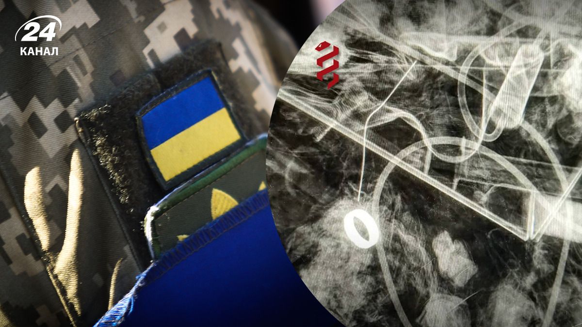 Обручальное кольцо раненого военного нашли с помощью рентгена