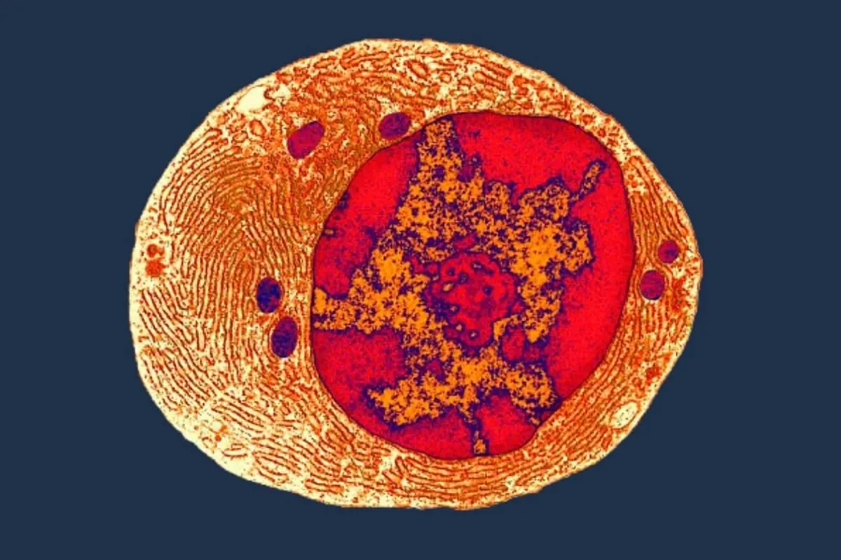 LUCA – Last Universal Common Ancestor