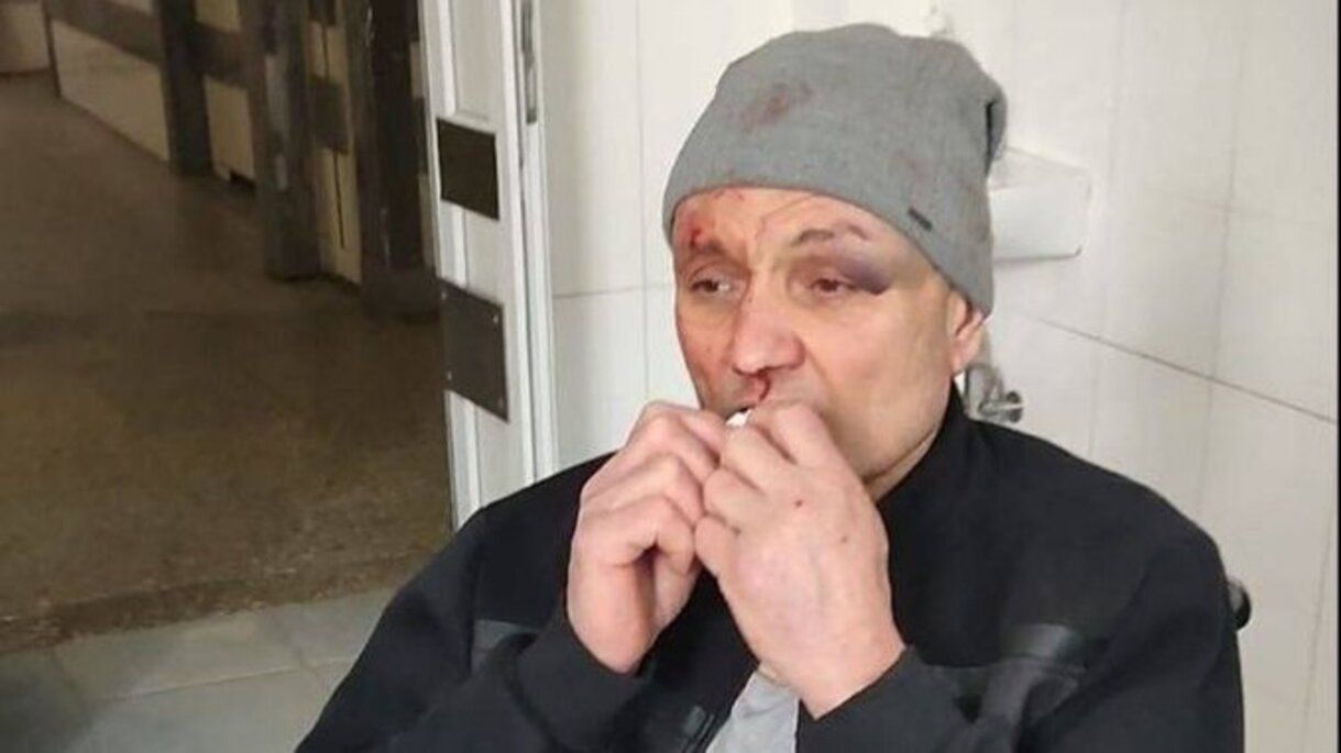 Побиття пенсіонера у ТЦК Побиття пенсіонера у ТЦК