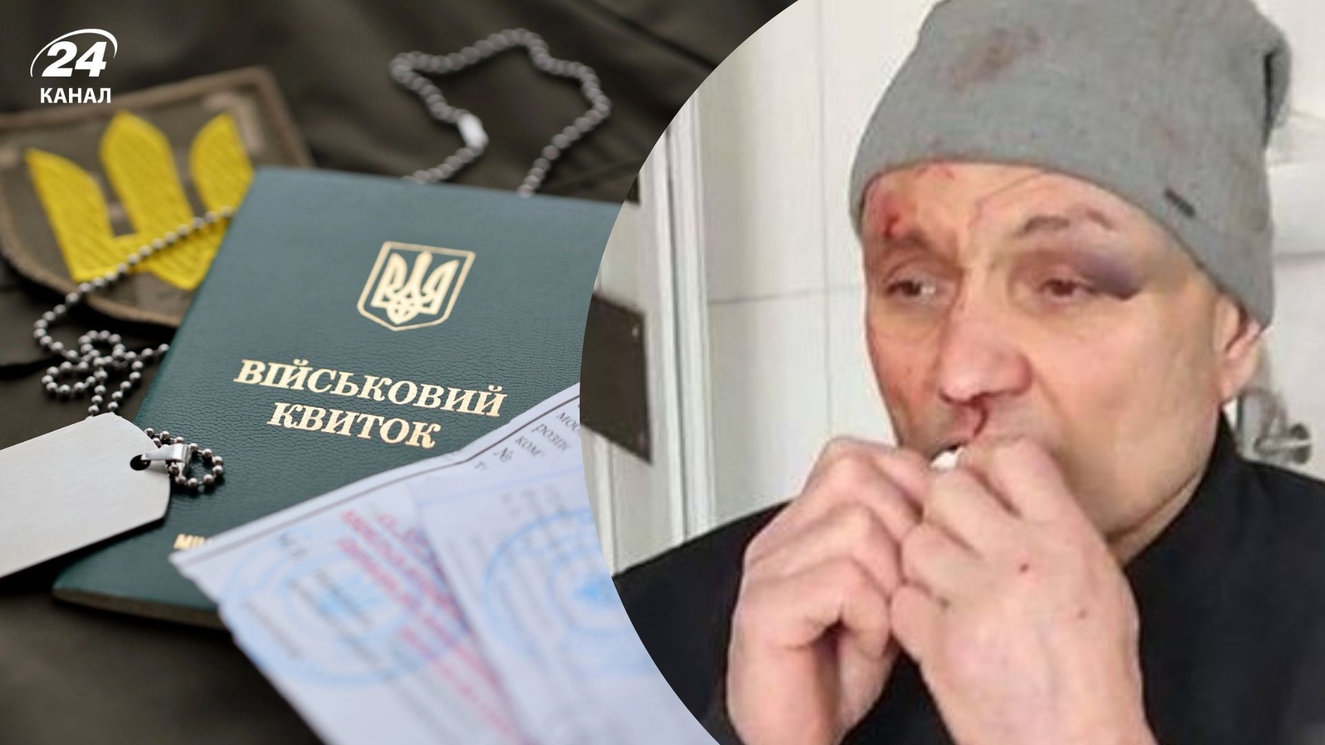 Військові ТЦК можуть бути причетні до побиття пенсіонера у Харкові Військові ТЦК можуть бути причетні до побиття пенсіонера у Харкові