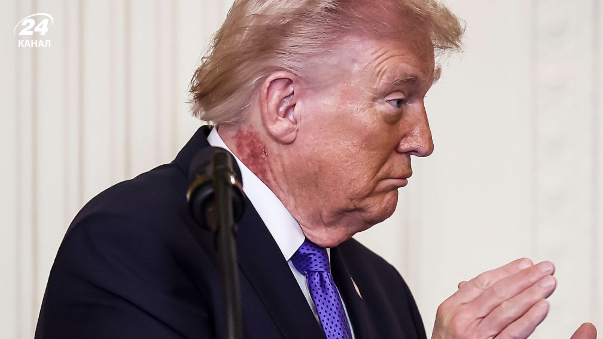 На шее Трампа заметили загадочное красное пятно На шее Трампа заметили загадочное красное пятно