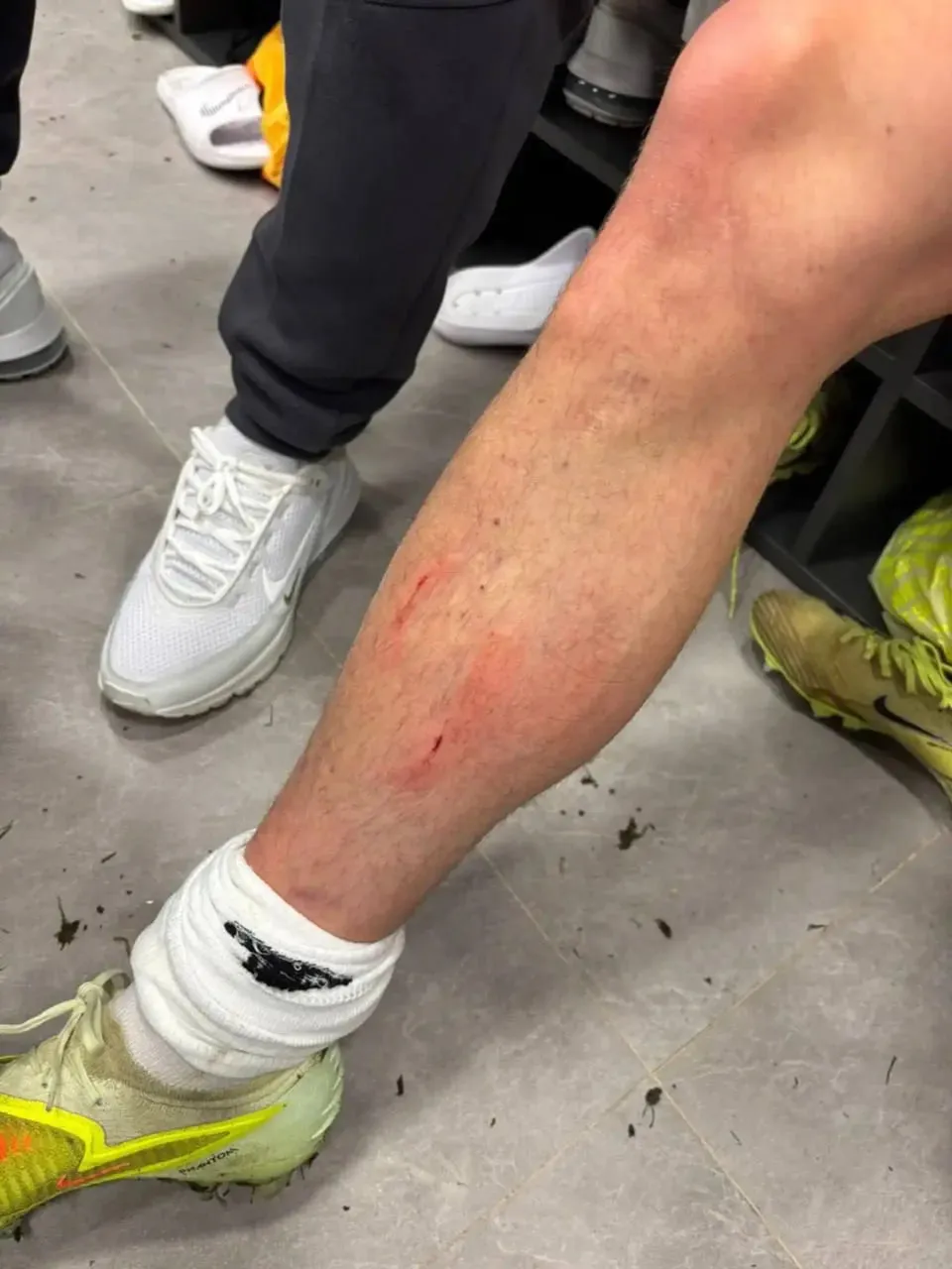 Фол Динамо, наслідки