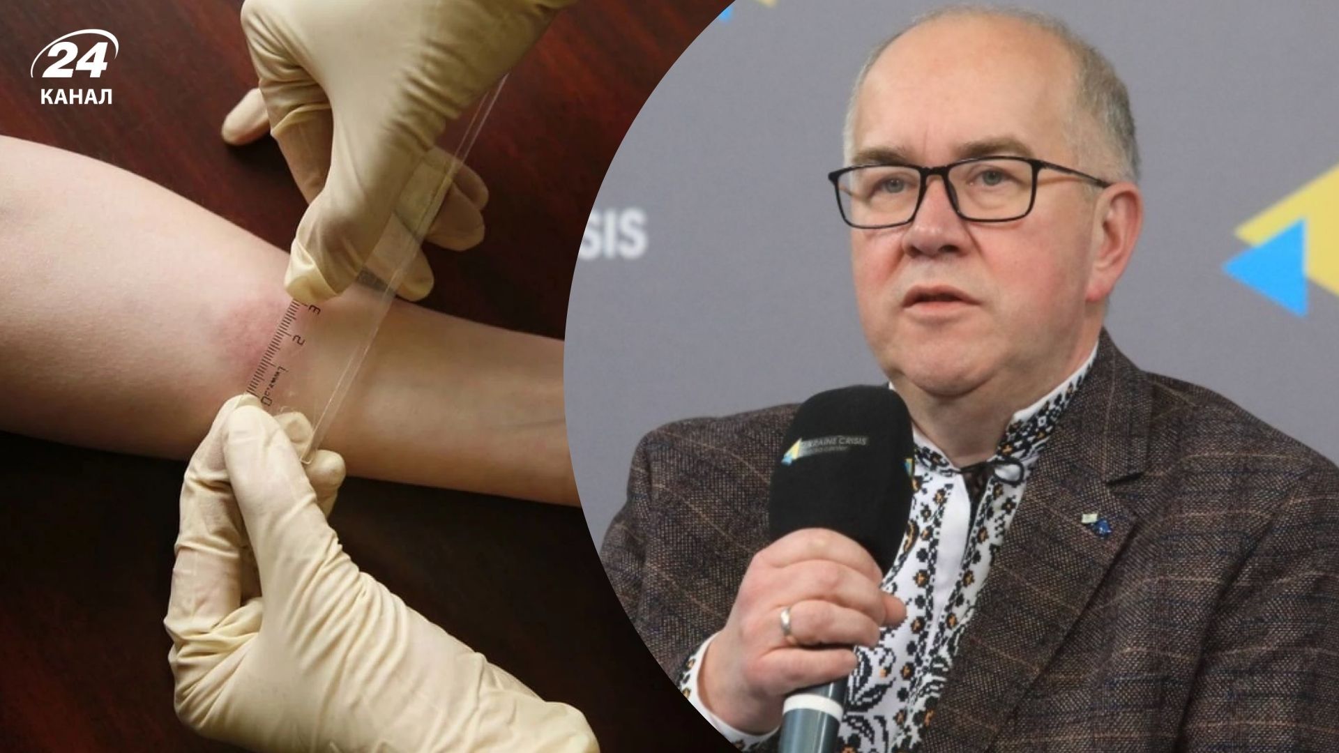 В Украине заменят тесты Манту на более эффективные В Украине заменят тесты Манту на более эффективные