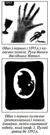 Один з перших рентгенівських знімків / фото Вікіпедії 