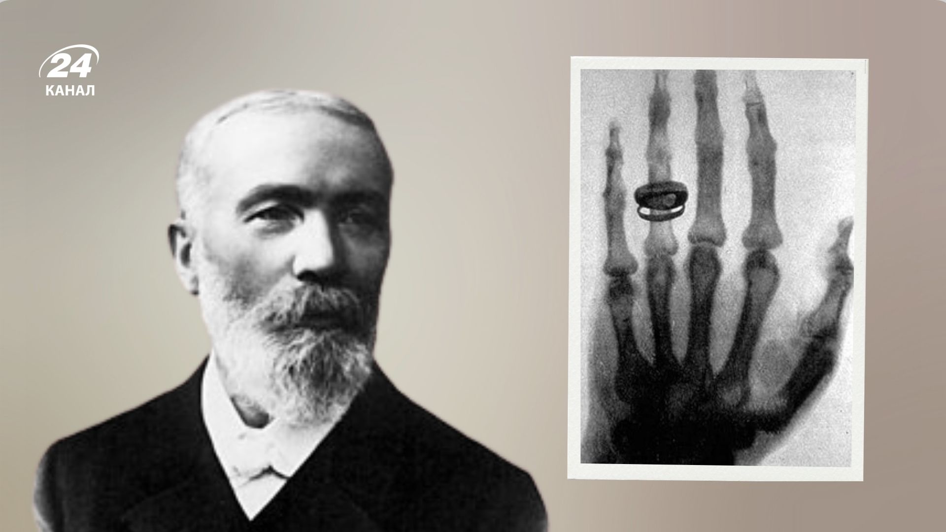 Как украинский гений Иван Пулюй создал рентгеновские лучи, а открытие забрал другой Как украинский гений Иван Пулюй создал рентгеновские лучи, а открытие забрал другой