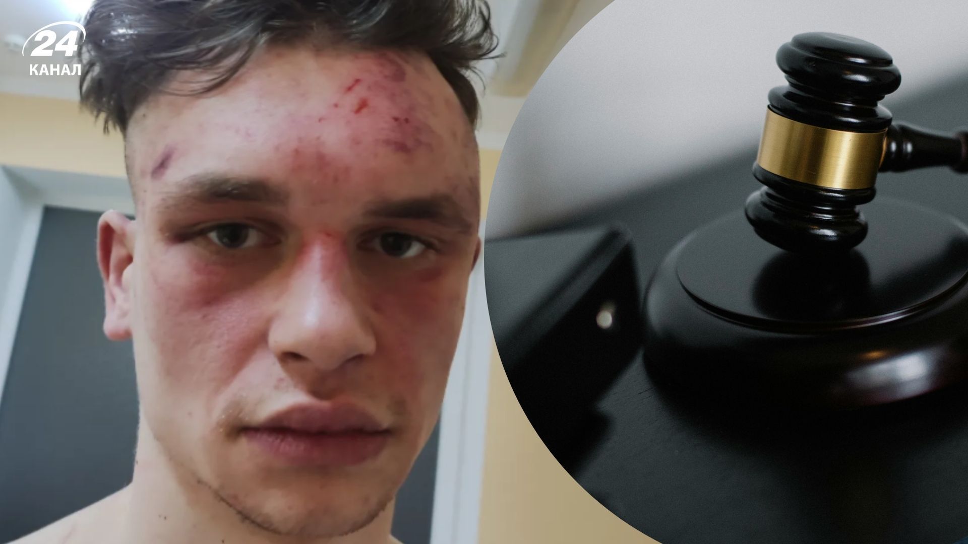 У Львові оголосили вирок поліцейським, які побили стендапера Максима Гіля У Львові оголосили вирок поліцейським, які побили стендапера Максима Гіля