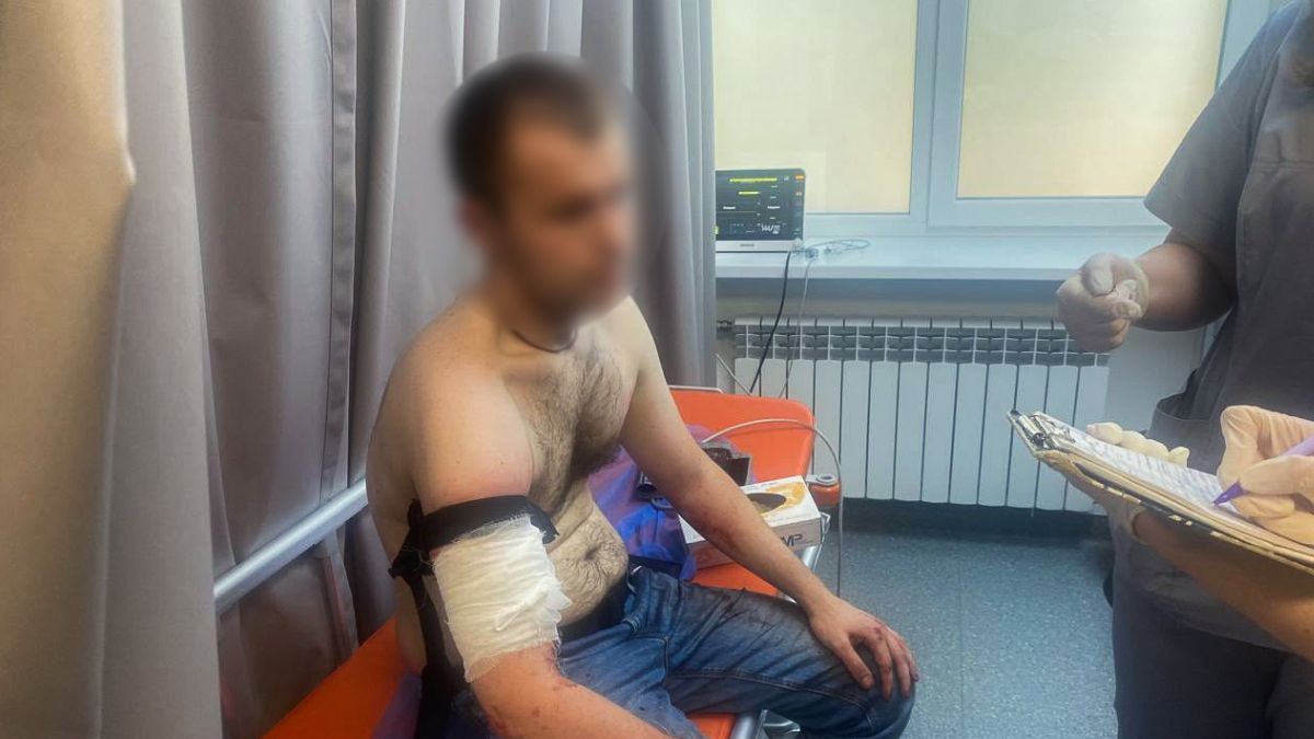 У Запоріжжі чоловік з ножем та сльозогінним газом напав на поліцейських: він загинув