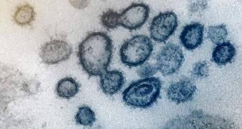 "Южноафриканский" штамм коронавируса в Украине: насколько он опасен