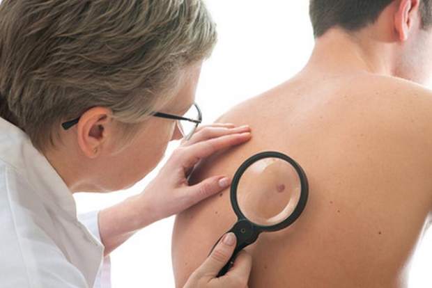Обстеження у лікаря рак шкіри 