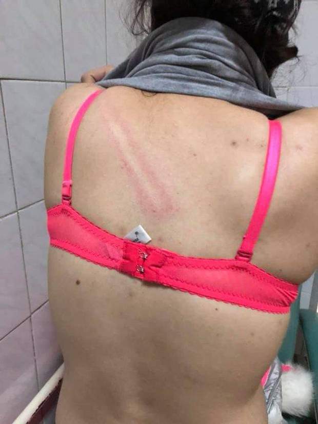 В киевском метро полицейские дубинками избили женщин: двое из них – беременные 3