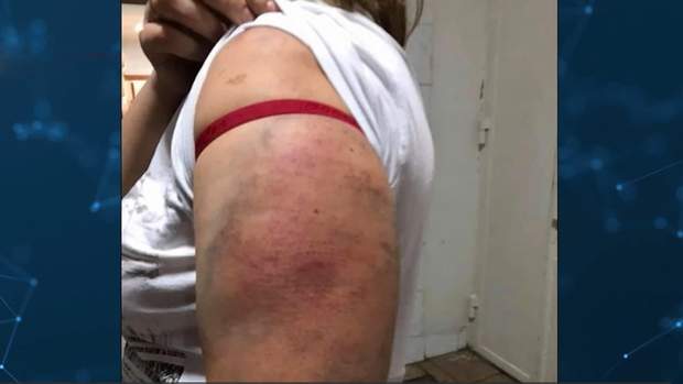 побиття жінок поліцейськими київ