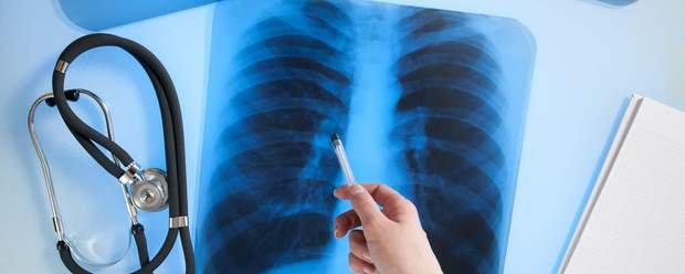 Опромінення має приносити більше користі, ніж шкоди Опромінення має приносити більше користі, ніж шкоди