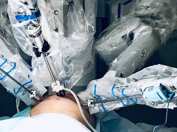 Першим пацієнтом робота-хірурга став 50-рчний чоловік з міста Броди