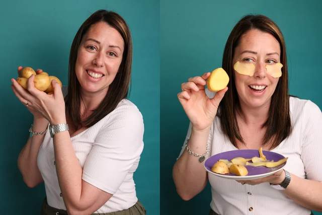 Неочікуване застосування: жінка показала, як зменшити кола під очима завдяки картоплі