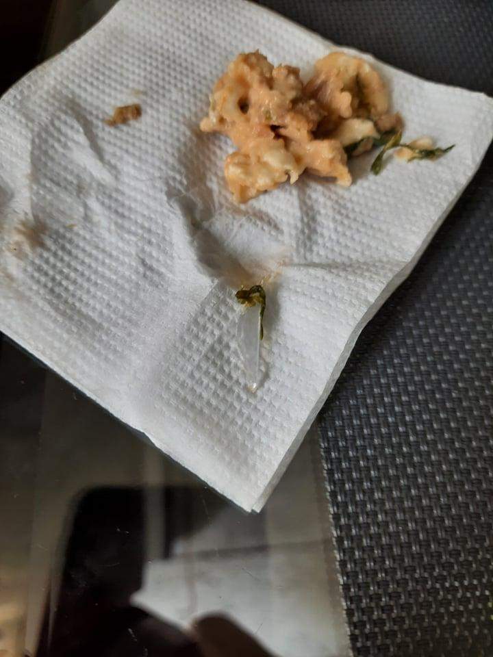 Щось закололо у роті: львів'янин виявив небезпечну знахідку в кебабі – фото